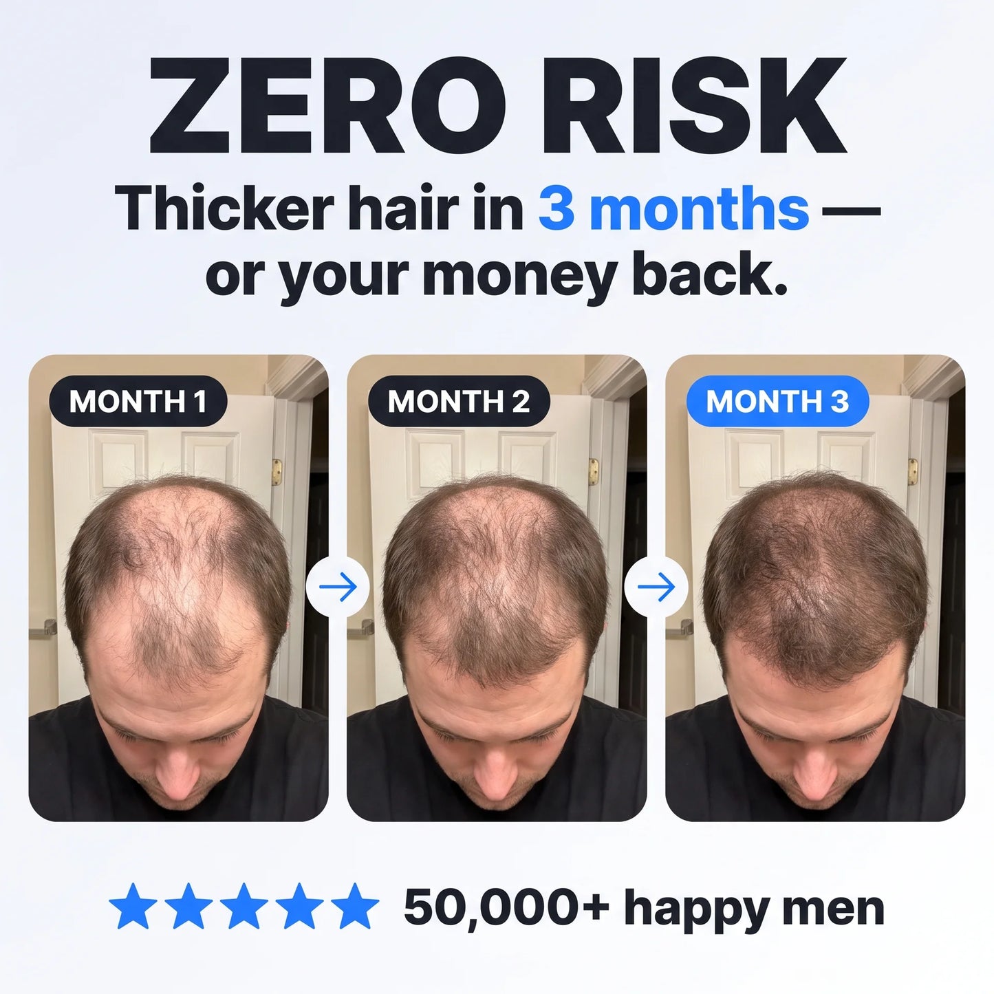 Peptide Infusion Hair Regrowth System