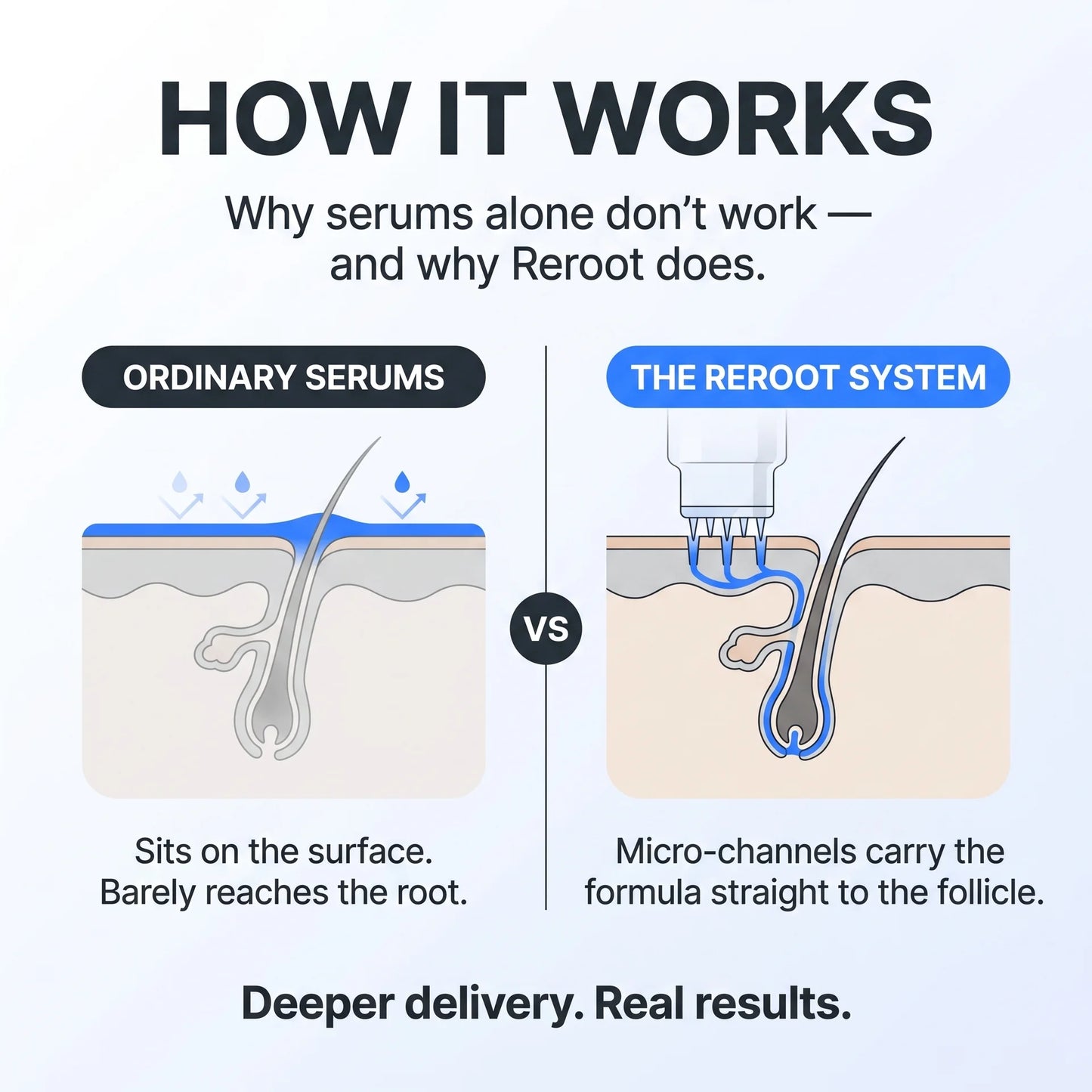 Peptide Infusion Hair Regrowth System