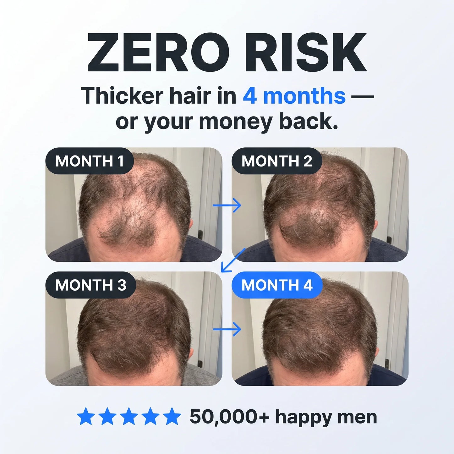 Peptide Infusion Hair Regrowth System