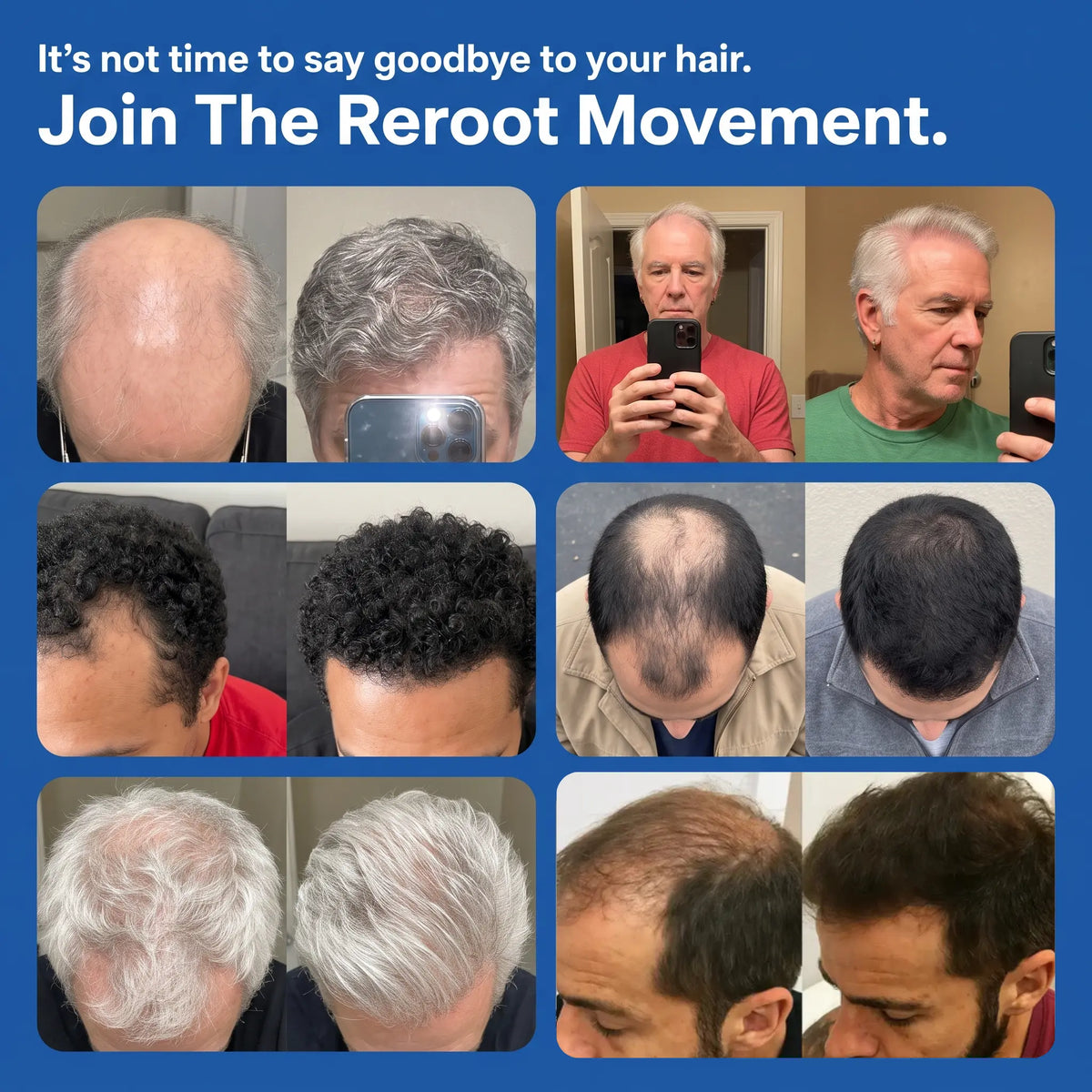 Peptide Infusion Hair Regrowth System