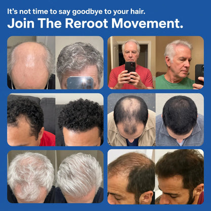 Peptide Infusion Hair Regrowth System