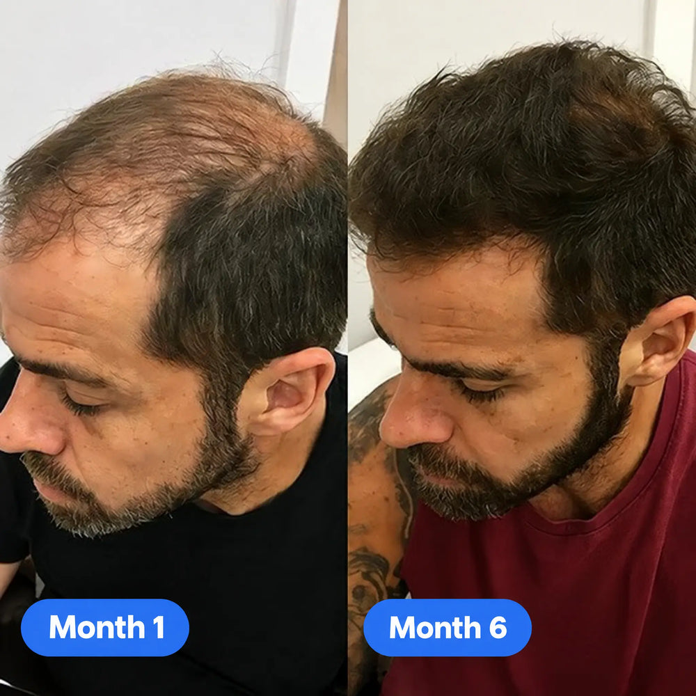 <p><strong>What Do 3-6 Month Results Look Like From People Who Used Reroot?</strong></p>